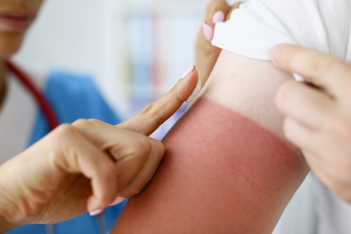 Featured image for Can the Skin Recover fromSun Damage